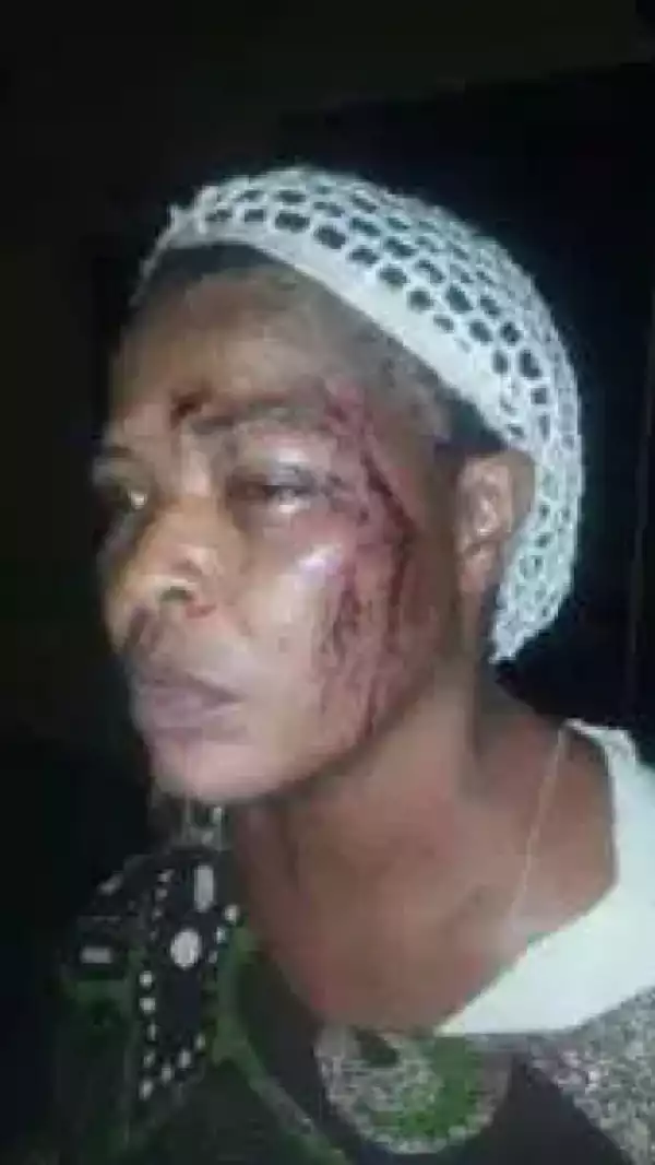 Photo: Landlady & Her Children Brutalize Woman Over Complain Of Peeping When Bathing